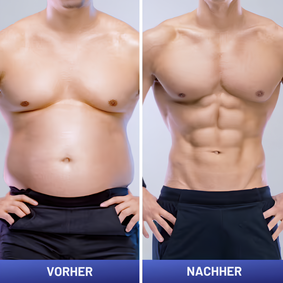 Professioneller EMS Muskelstimulator