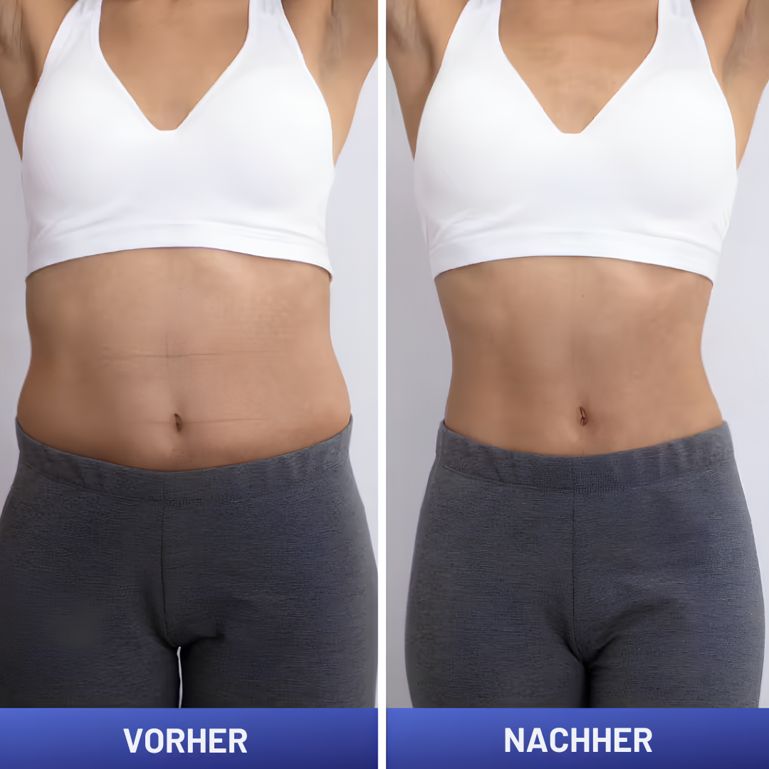 Professioneller EMS Muskelstimulator